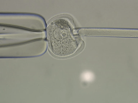 Usunięcie kropli lipidowych z komórki jajowej 